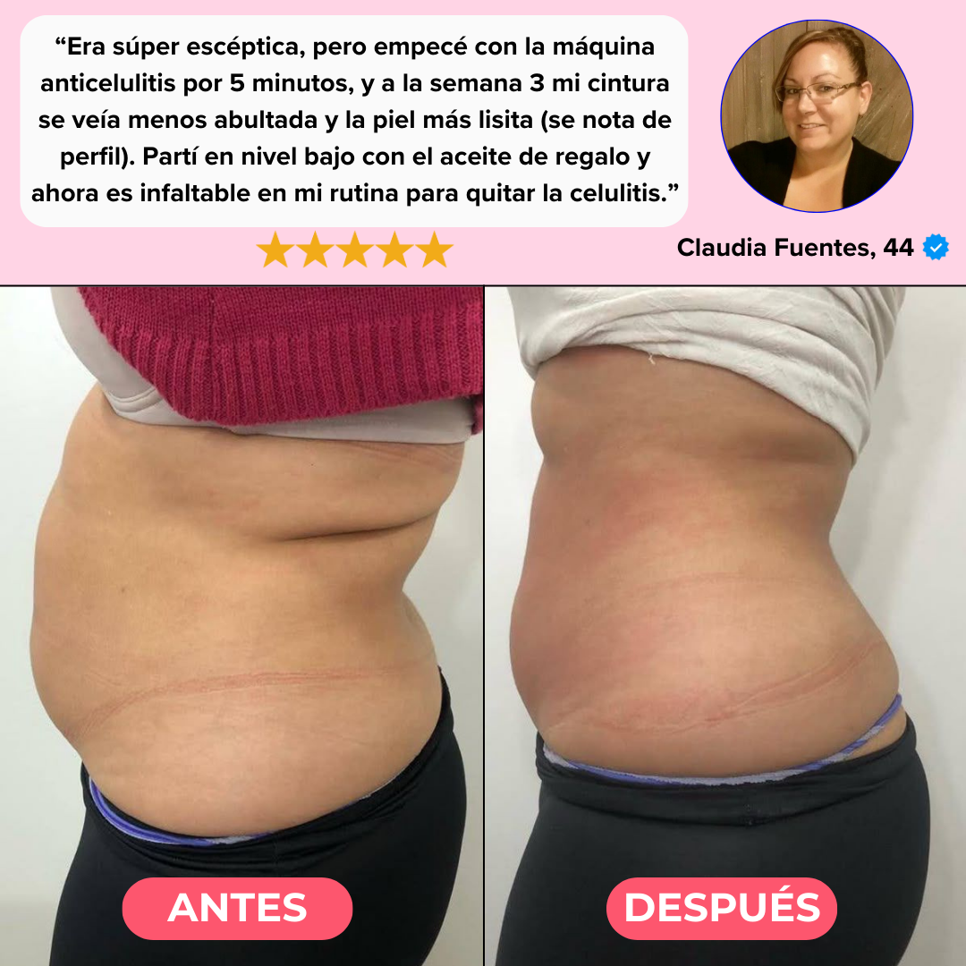 Kit Velia Pro® Elimina Celulitis y Grasa Localizada en 21 días