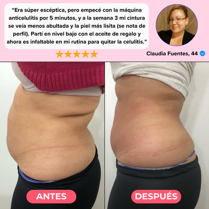 Kit Velia Pro® Elimina Celulitis y Grasa Localizada en 21 días
